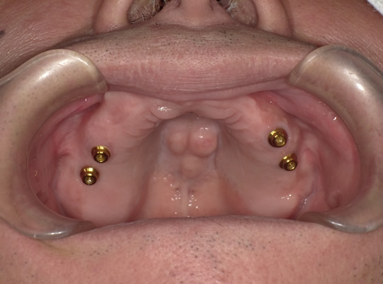 CvgǗ1